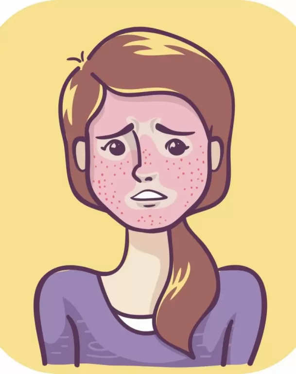 Rubor Facial - Como a simpatectomia pode ajudar?